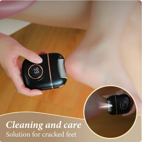 Electric Foot Callus Remover
